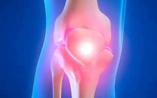 Causes of Knee Osteoarthritis