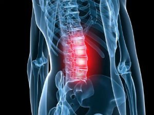 Osteochondrosis of the lumbar spine