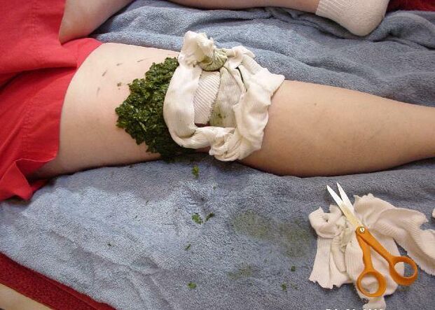 A warm compress of crushed cabbage leaves on the painful knee joint with arthrosis